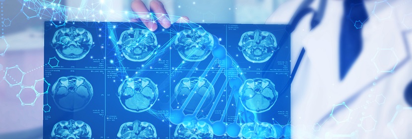 DSA(數字減影血管造影)放射衛生檢測評價