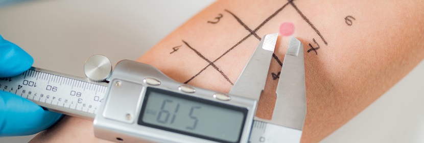 化妝品皮膚變態(tài)反應試驗