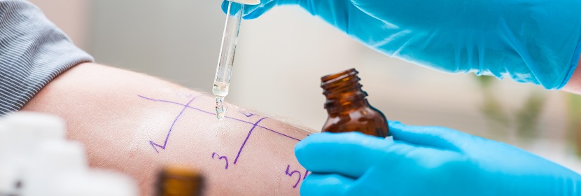 皮膚變態(tài)反應(yīng)試驗