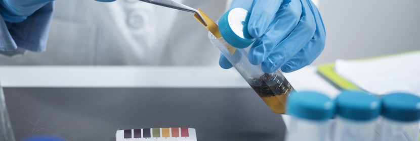 化學(xué)品哺乳動(dòng)物細(xì)胞基因突變?cè)囼?yàn)