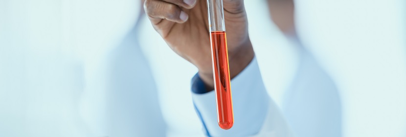 硫化促進(jìn)劑ZEHBP檢測(cè)