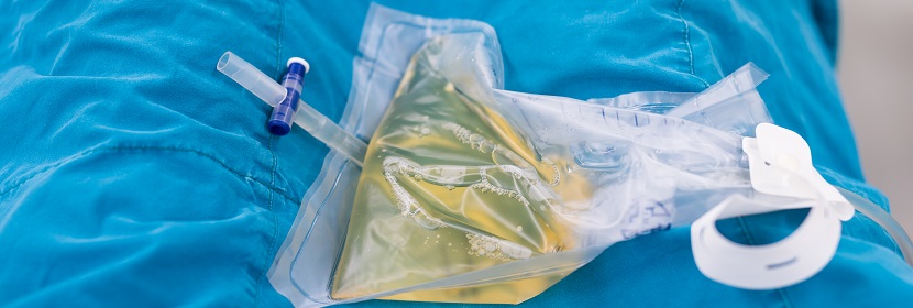 集尿袋檢測(cè)