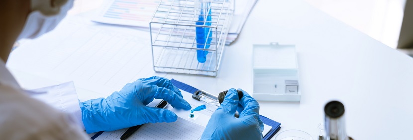 固定室?guī)秸婵者^濾機用橡膠濾帶檢測